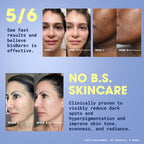 bioBare® Vitamin C, B, E & Ferulic Serum | 20% Pure Vitamin C Facial Serum with Hyaluronic Acid, Niacinamide & Ferulic Acid | L-Ascorbic Acid Serum for Dark Spots, Fine Lines, Wrinkles, Uneven Skin