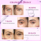 ICIKOL Under Eye Patches with Collagen, Eye Patches for Puffy Eyes and Dark Circles, 360° Under Eye Mask for Puffiness, Wrinkles, Fine Lines, Gifts for Women - Skin Care, 12 Pairs (White)