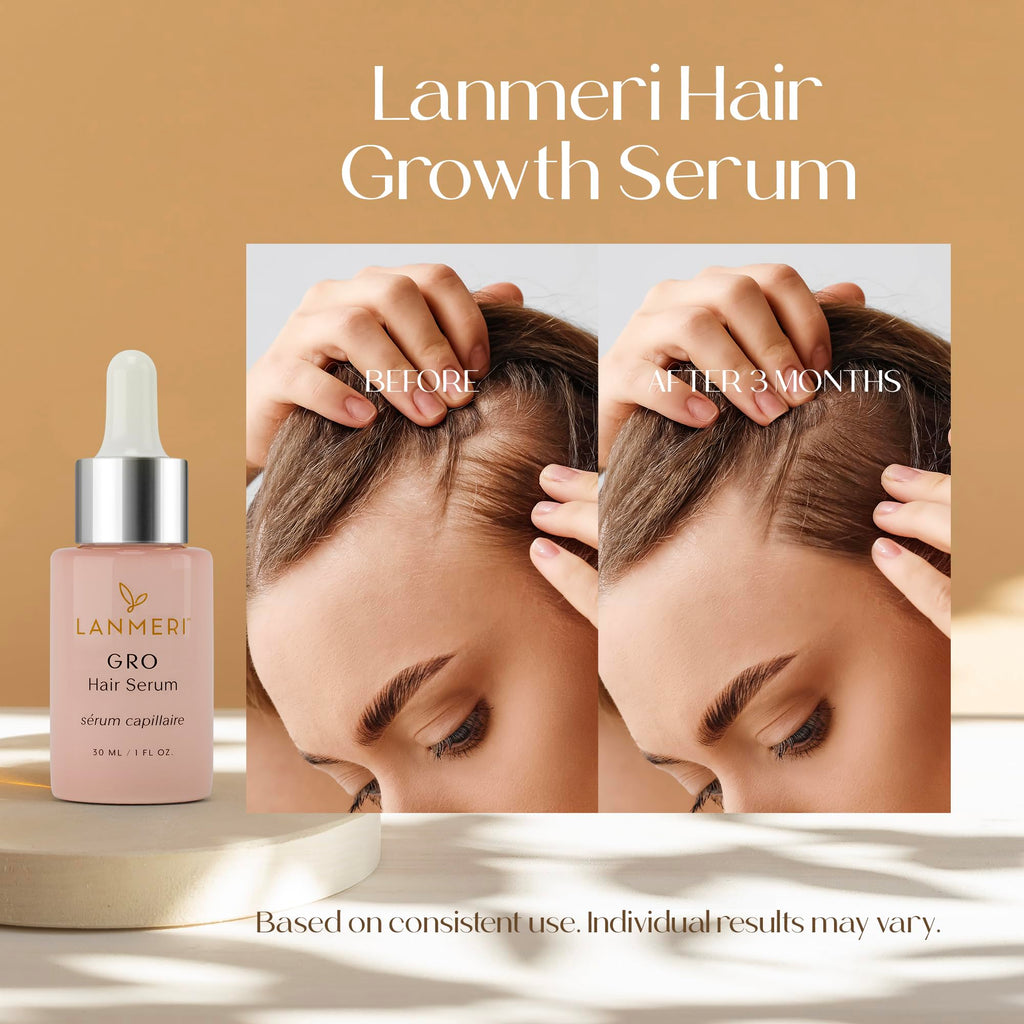 Lanmeri Vegan Hair Growth Serum - Natural Hair Regrowth and Hair Loss Treatments for Women & Men - Scalp Serum for Thinning Hair - Fuller, Thicker and Healthier Hair in 90 Days, All Hair Types