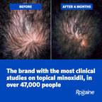 Men's Rogaine 5% Minoxidil Topical Foam, Unscented, 3 x 2.11 oz