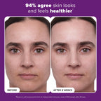 Paula's Choice CLINICAL 1% Retinol Face Treatment with Peptides, Vitamin C & Licorice Extract, Anti-Aging Skin Care Serum, Fine Lines & Wrinkles, Fragrance Free, 1 Fl Oz