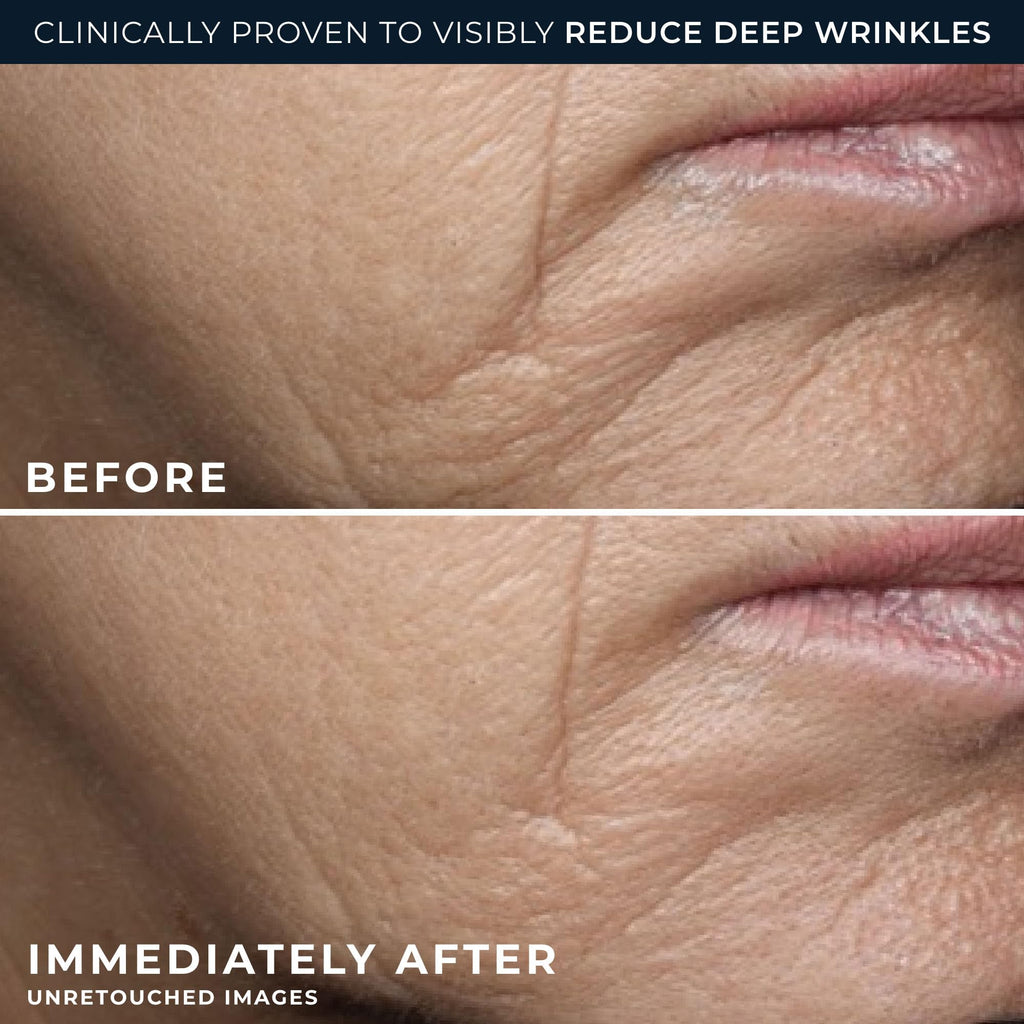RoC Deep Wrinkle Rich Cream, Fragrance Free, Daily Anti-Aging Firming Cream For Persistent Dryness & Younger-Looking Skin For Women & Men, With Line Smoothing Eye Cream Packette, 1.7oz