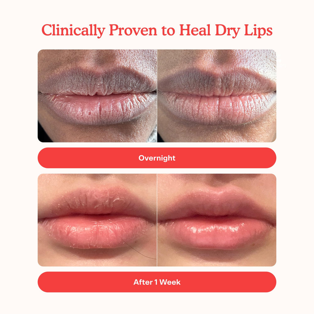 Tower 28 LipSoftie Tinted Lip Balm Treatment - Hydrating Glossy Balm + Overnight Lip Mask with Jojoba Oil + Shea Butter - Sweet, Cushiony Formula for Smooth, Soft Lips - Sugar Plum (0.38 oz)