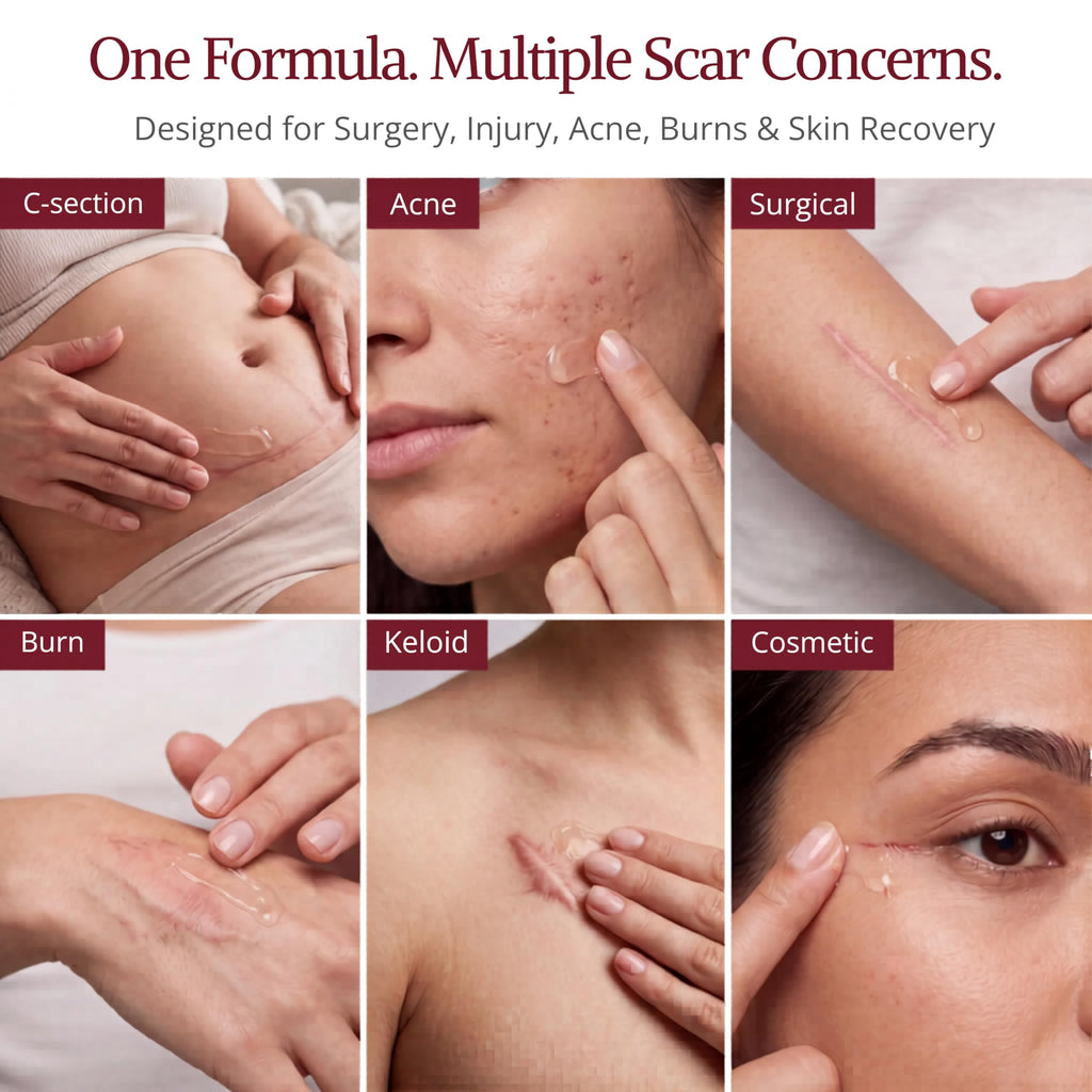 HealFast Silicone Scar Gel & Cream for Surgical Scars - Medical Grade Scar Treatment & Removal for Keloid, Acne, Burns, C Section, Stretch Marks - Physician Formulated Advanced Silicone Gel for Scars