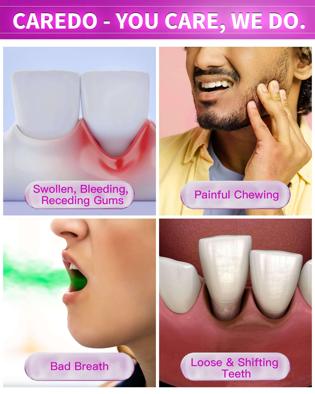 CAREDO Gum Toothpaste for Periodontitis, Gum Repair for Receding Gums, Gum Disease & Gingivitis Treatment, Periodontal Disease Treatment for Gum Health, Gum Disease Repair Bad Breath Toothpaste 3.52OZ