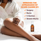 Palmer's Cocoa Butter Formula Scar Serum, Skin Brightening Oil for Face & Body, Concentrated Serum with Vitamin E, Fragrance Free, 1 Fl Oz