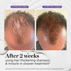 Dr. Groot Miracle in Shower Treatment for Hair Loss, Korean Hair Care, 5 Seconds to Smooth Hair, Rosemary Oil for Healthier-Looking Hair, Hair Rinse, Moisturizing Treatment,Scalp Revitalizing Solution