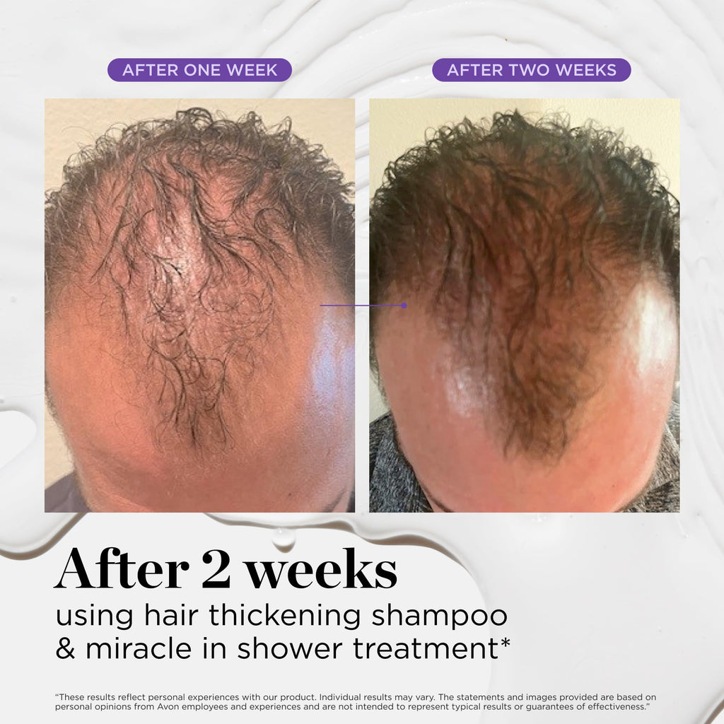 Dr. Groot Miracle in Shower Treatment for Hair Loss - Korean Care 5-Second Smoothing Solution With Rosemary Oil, Moisturizing Scalp Revitalizing Rinse