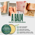 KESMEDIK Tea Tree Oil Balm for Skin, Soothes Itching, Rashes & Dry Skin, Antifungal Defense for Athlete’s Foot, Jock Itch, Chafing, Bug Bites & Eczema, Natural, Effective & Safe for All Ages