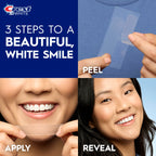 Crest 3D Whitestrips Professional Effects – Teeth Whitening Kit, 22 Treatments (20 + 2 Bonus), Each with 1 Upper/1Lower, 44 Strips – Crest 3DWhite Teeth Whitening Strips