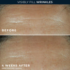 RoC Retinol Correxion Wrinkle Filler for Deep Wrinkles with Hyaluronic Acid & Retinol, Skin Care for Women and Men, 1 Fl Oz (Packaging May Vary)