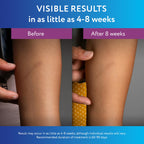 ScarAway Silicone Scar Gel, Helps Improve Size, Color & Texture of Hypertrophic & Keloid Scars from Injury, Burns & Surgery, Water Resistant, 20g (0.7 Oz)