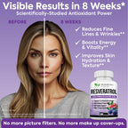 Extra Strength Resveratrol 1568mg - 180 Capsules - 3 Months Supply | Antioxidant Supplement | Natural Trans-Resveratrol Pills | for Anti-Aging, Heart Health, Immune System & Brain Function
