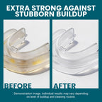 Retainer Cleanser Tablets Cleaner, Removes Odors Discoloration Stains and Plaque 2 Month Supply Denture Cleansers Retainers Mouth Guards Denture Bath Mint by M3
