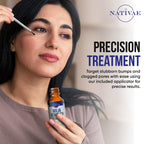 Milia Remover Treatment for Eyes & Face - Milia Spot Treatment with Salicylic Acid & Tea Tree Oil - Milia Acne Serum