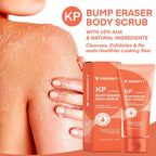 Skin Care Set- KP Bump Eraser Body Scrub and the Stretch Mark Prevention Cream
