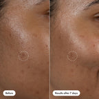 Hero Cosmetics Dark Spot Correct Spot-Fading 15% Vitamin C plus Hyaluronic Acid Serum. Improves the Look of Post Blemish Marks in 7 Days. Twist Applicator and Rollerball Tip for Easy Application. 10mL