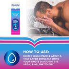 Clearasil Ultra Rapid Action Gel - Salicylic Acid Skin Moisturizer for Adults, Exfoliating & Smoothing, 25ml