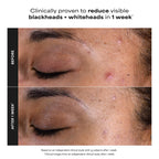Paula's Choice SKIN PERFECTING 2% BHA Liquid Leave-On Exfoliant, 4 Fl Oz