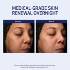 Obagi Medical Retinol + PHA Refining Night Cream - Clinically Proven, Dual-Action, Overnight Anti-Aging Face Cream for Smoother, Renewed Skin & a More Even-Looking Complexion - 1.7 Oz