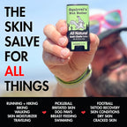 Squirrel's Nut Butter Anti Chafe Stick | All Natural Chafe Prevention & Skin Care for Athletes, Runners & Adventurers | Thighs, Arms, Pack Straps & More | 2.7 oz