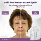 Beverly Hills V-Lift Instant Eye Lift and Eye Tuck Bee Venom Serum for Puffy Eyes, Dark Circles, Wrinkles, and Under Eye Bags Treatment for Women and Men | 30mL (120 Day Supply)