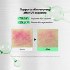 VT COSMETICS CICA Reedle Shot 700, Spicule Microneedling Serum for Pore Care&Exfoliation, Exosome&Centella Asiatica for Glass Skin, Acne&Blemish Care, Korean Liquid Skin Booster (1 Fl Oz / 30ml)