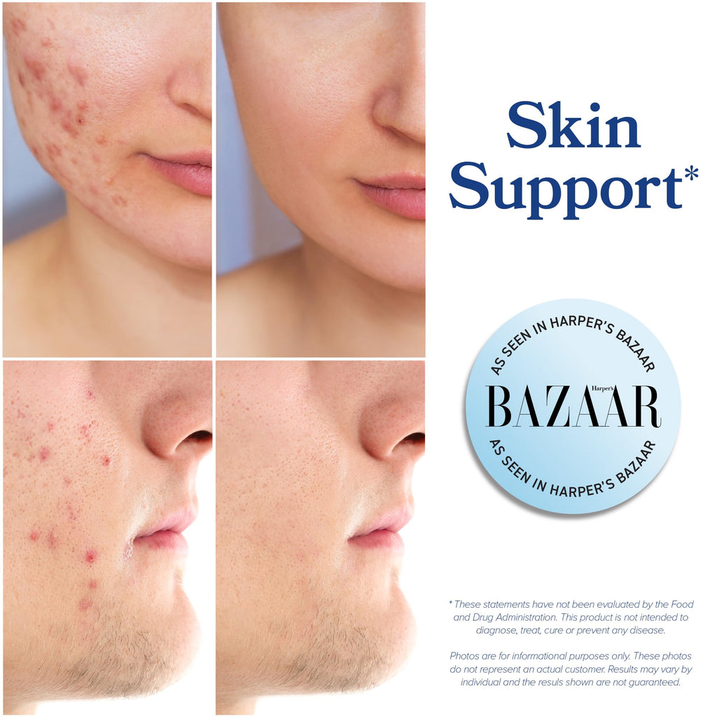 DIM Supplement 200 mg | Estrogen Balance for Women & Men | Hormonal Acne, Hormone Balance, Menopause & Antioxidant Support | Clean Label Project Certified, Vegan & Soy Free Diindolylmethane | 60 Ct.