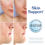 DIM Supplement 200 mg | Estrogen Balance for Women & Men | Hormonal Acne, Hormone Balance, Menopause & Antioxidant Support | Clean Label Project Certified, Vegan & Soy Free Diindolylmethane | 60 Ct.