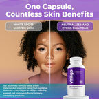 AURA VITAMINS - Vitiligo Capsules 60 Count | 1 Month | Improve Skin Pigmentation Support and Reduce White Spots | Effective Vitiligo Supplement | Natural Solution for White Spots on Skin. (1)