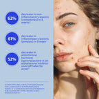 Codex Labs Shaant Skin De-Stress Supplement for Women, 30 Servings