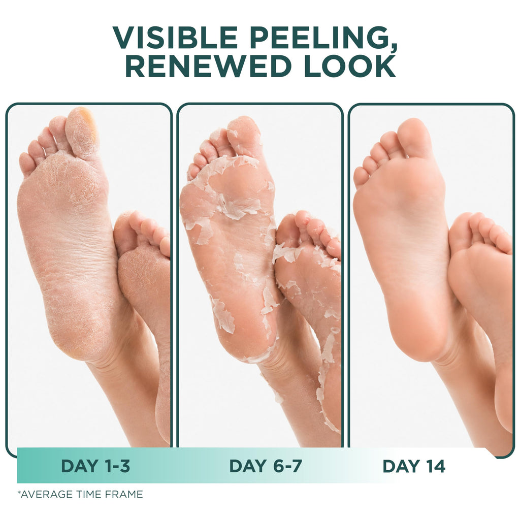 DERMORA Foot Peel Mask, Exfoliating Foot Peeling Mask, 2 Pairs, Original