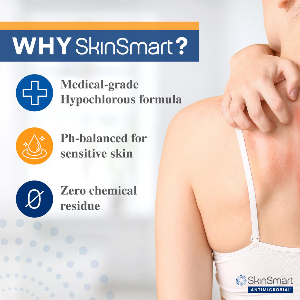 SkinSmart Antimicrobial Eczema Therapy with Hypochlorous Acid, Safely Removes Bacteria so Skin Can Heal, for Adults, Kids and Seniors, 8 Ounce Clear Spray
