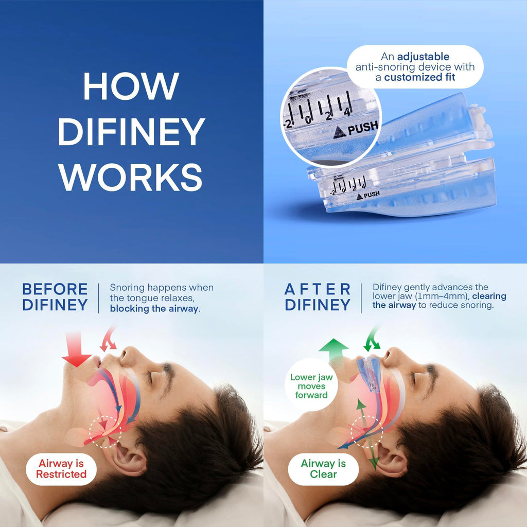 Difiney Anti Snoring Device: FDA-Cleared Anti Snoring Mouthpiece – Adjustable Snore Stopper Mouth Guard for Men & Women to Sleep Better – Reusable Nighttime Use with Storage Case