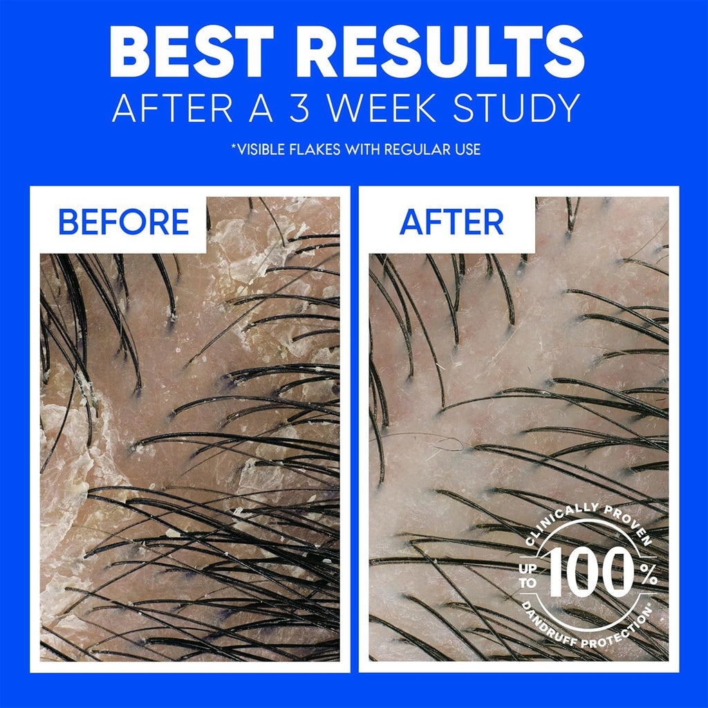 Head & Shoulders Tea Tree Oil 2-in-1 Anti-Dandruff Shampoo and Conditioner Twin Pack, 72-Hour Protection, 1% Pyrithione Zinc, 32.1 fl oz Each
