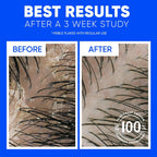 Head & Shoulders Tea Tree Oil 2-in-1 Anti-Dandruff Shampoo and Conditioner Twin Pack, 72-Hour Protection, 1% Pyrithione Zinc, 32.1 fl oz Each