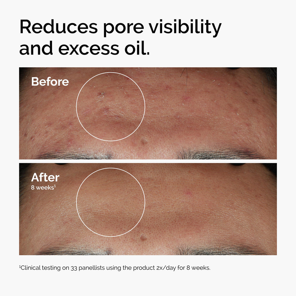 The Ordinary Serum Favorites Set – Hyaluronic Acid 2% + B5, Niacinamide 10% + Zinc 1%, Caffeine Solution 5% – Eye and Face Serums for Hydrating, Brightening & Pore-Minimizing Skin Care