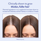 Routine Wellness Hair Growth Supplement – CLINICALLY Tested Thicker, Fuller-Looking Hair Support with Biotin & Key Nutrients, Vegetarian & Gluten-Free Vitamins - 2 Bottles, 60 Day Supply