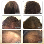 Joyce Giraud Ultimate Hair Strength Supplements 30-Day Supply, Scientifically Formulated to Reduce Hair Loss, 60 Capsules