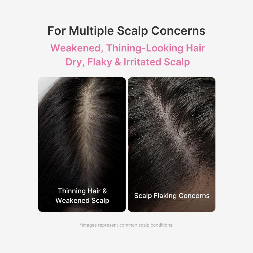 medicube Scalp Serum with Rosemary PDRN for Thicker, Denser-Looking Hair