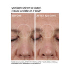 DRMTLGY Needle-less Growth Factor Serum for Face – Multi-Peptide & Hyaluronic Acid Facial Serum, Firming & Lifting, Skin Barrier Support & Wrinkle Care