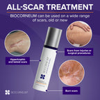 Biocorneum Advanced Scar Treatment – Silicone Scar Gel with Silishield® & SPF 30 20g – Scar Cream for Surgical Scars, C-Section & Acne – Fast Drying, Water Resistant Scar Removal Gel - for Children