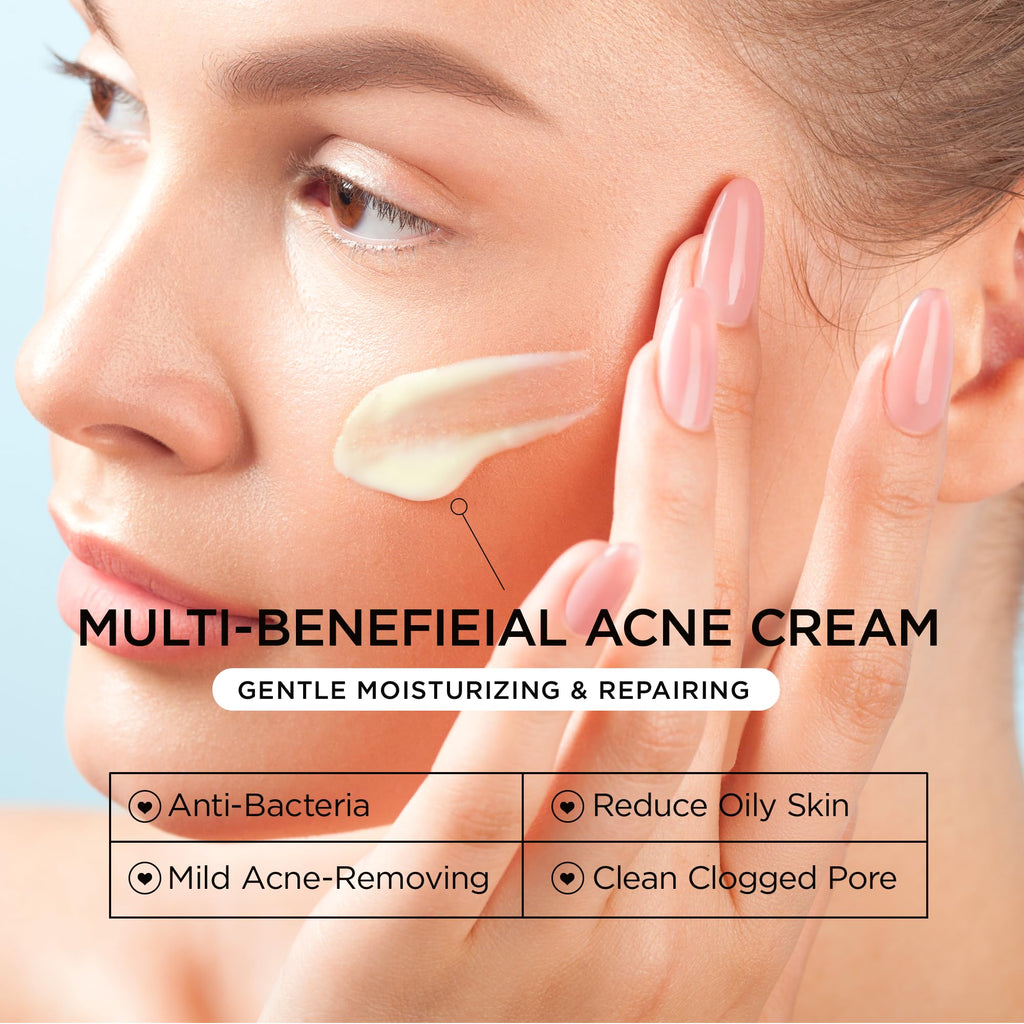 Cystic Acne Spot Treatment for Face: Hormonal Acne Pimple Cream with Salicylic Acid & Tea Tree Oil - Hormonal & Pimple Cream for Teens & Adults,120 Day Supply & 3.38 oz / 100 ml