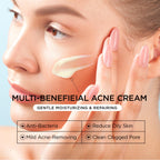 Cystic Acne Spot Treatment for Face: Hormonal Acne Pimple Cream with Salicylic Acid & Tea Tree Oil - Hormonal & Pimple Cream for Teens & Adults,120 Day Supply & 3.38 oz / 100 ml