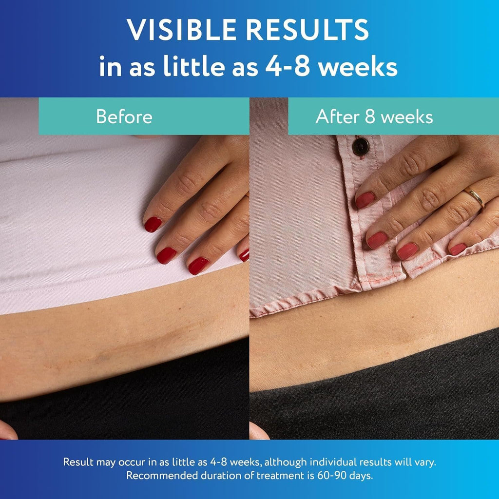 ScarAway Advanced Clear Silicone Scar Sheets, Medical Grade Silicone Strips (1.5" x 3") Scar Treatment and Prevention for Surgical, Burn, Body, Hypertrophic & Keloid Scar Treatment, 6 Clear Sheets