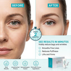 Instantly Ageless - Instant Face Lift Cream - Skin Care for Anti Aging Face Cream & Moisturizer with Vitamin C - Wrinkle Tightener - Instant Under Eye Bags Remover - Facelift in a Box of 25 Vials