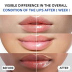 Lip Sleeping Mask (20g), Collagen Lip Mask Overnight, Lip Plumper with Hyaluronic Acid, Peptide Complex Lip Balm for Lip Wrinkle Repair and Plumping, Natural Hydration for Smooth Lips