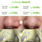 Dr.Melaxin CACTOX 3-STEP NOSE MASK PACK with AHA & PHA for Sebum Softening Pore Tightening Skin Repair 3-Step Nose Pore Pack
