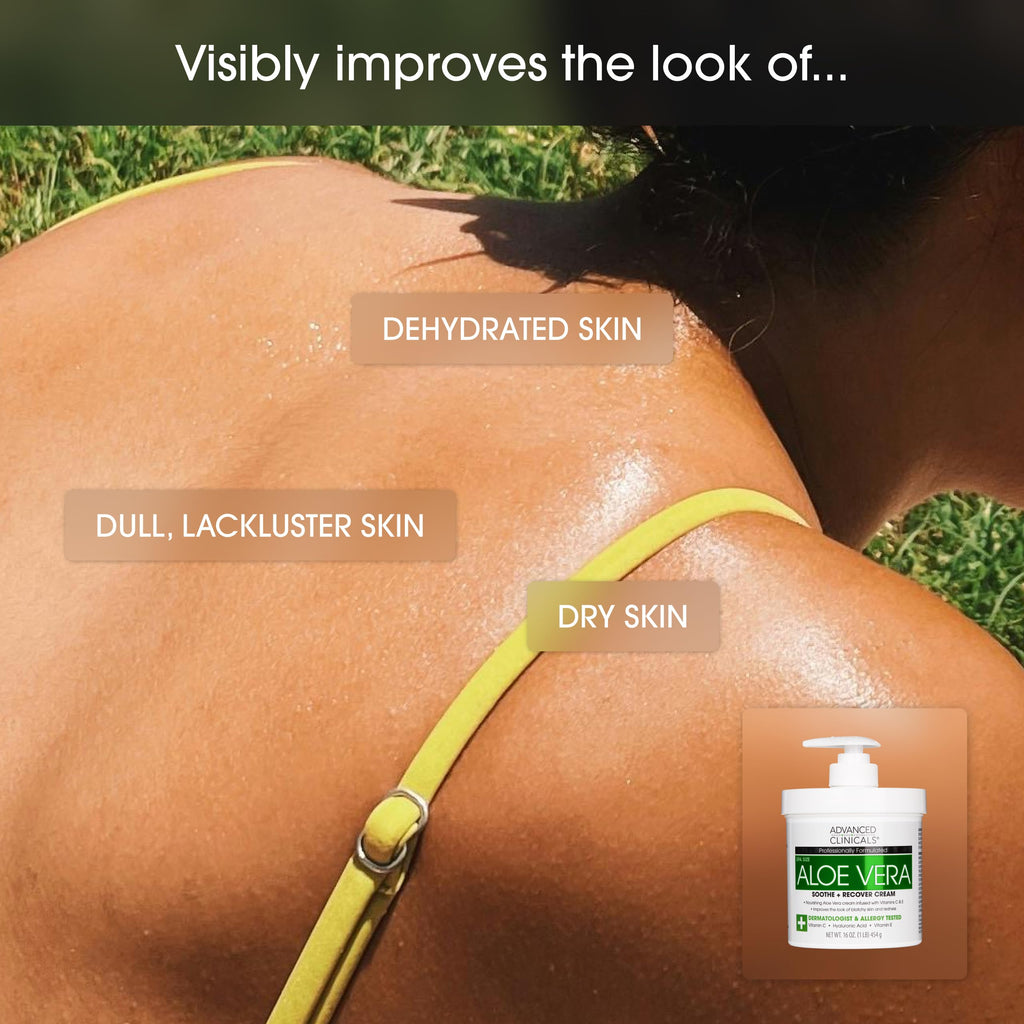 Advanced Clinicals Aloe Vera Lotion Skin Care Relief Cream | Vitamin E Infused Hyaluronic Acid Moisturizer & Vitamin C Body Lotion For Women & Men Helps Improve Look Of Extremely Dry Skin, 16 Ounce