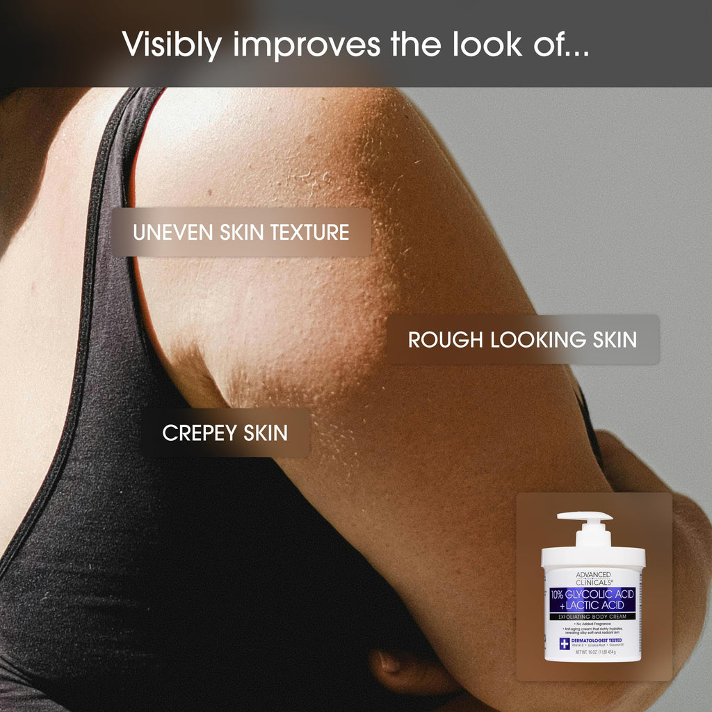 Advanced Clinicals Brightening Vitamin C Body Cream + AHA Exfoliating 10% Glycolic Acid & Lactic Acid Lotion 2PC Skincare Set For Women & Men To Reduce Appearance Of Dark Spots & Uneven Skin Tone